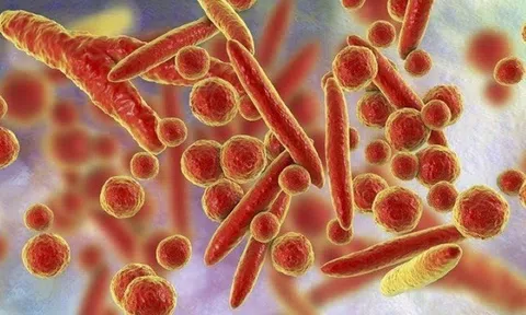 Trẻ mắc viêm phổi do Mycoplasma chiếm 30% số ca nằm nội trú hô hấp