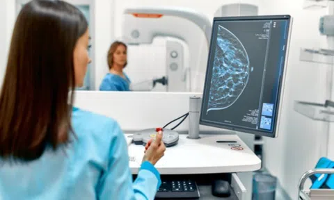 Nghiên cứu ứng dụng AI trong việc chẩn đoán ung thư vú