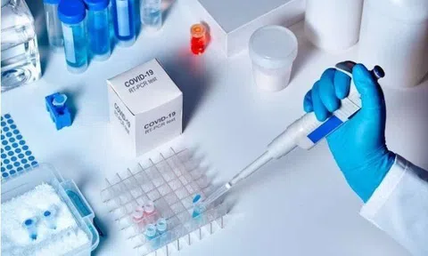 Điều chuyển thuốc, vật tư, sinh phẩm đã mua từ nguồn ngân sách nhà nước cho phòng, chống dịch COVID-19 sang nguồn thu dịch vụ khám bệnh, chữa bệnh